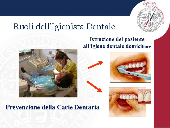 Ruoli dell’Igienista Dentale Istruzione del paziente all’igiene dentale domiciliare Prevenzione della Carie Dentaria 