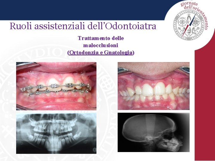 Ruoli assistenziali dell’Odontoiatra Trattamento delle malocclusioni (Ortodonzia e Gnatologia) 