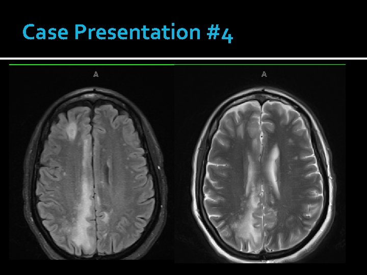 Case Presentation #4 