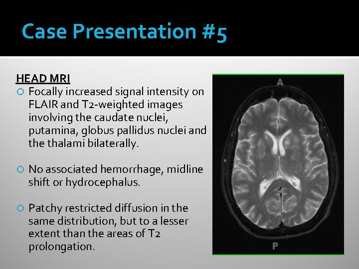 Case Presentation #5 HEAD MRI Focally increased signal intensity on FLAIR and T 2