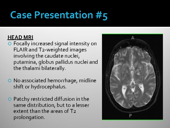 Case Presentation #5 HEAD MRI Focally increased signal intensity on FLAIR and T 2