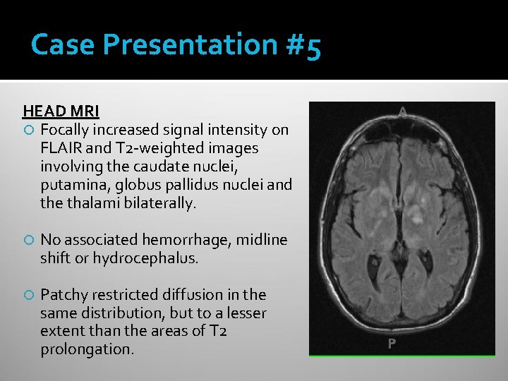 Case Presentation #5 HEAD MRI Focally increased signal intensity on FLAIR and T 2