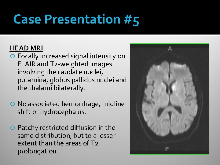 Case Presentation #5 HEAD MRI Focally increased signal intensity on FLAIR and T 2