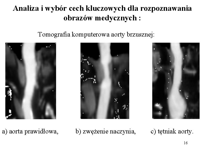 Analiza i wybór cech kluczowych dla rozpoznawania obrazów medycznych : Tomografia komputerowa aorty brzusznej: