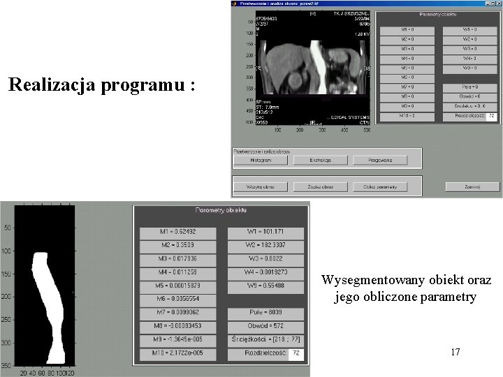 Realizacja programu : Wysegmentowany obiekt oraz jego obliczone parametry 17 