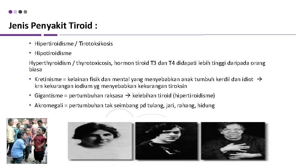 Jenis Penyakit Tiroid : • Hipertiroidisme / Tirotoksikosis • Hipotiroidisme Hyperthyroidism / thyrotoxicosis, hormon