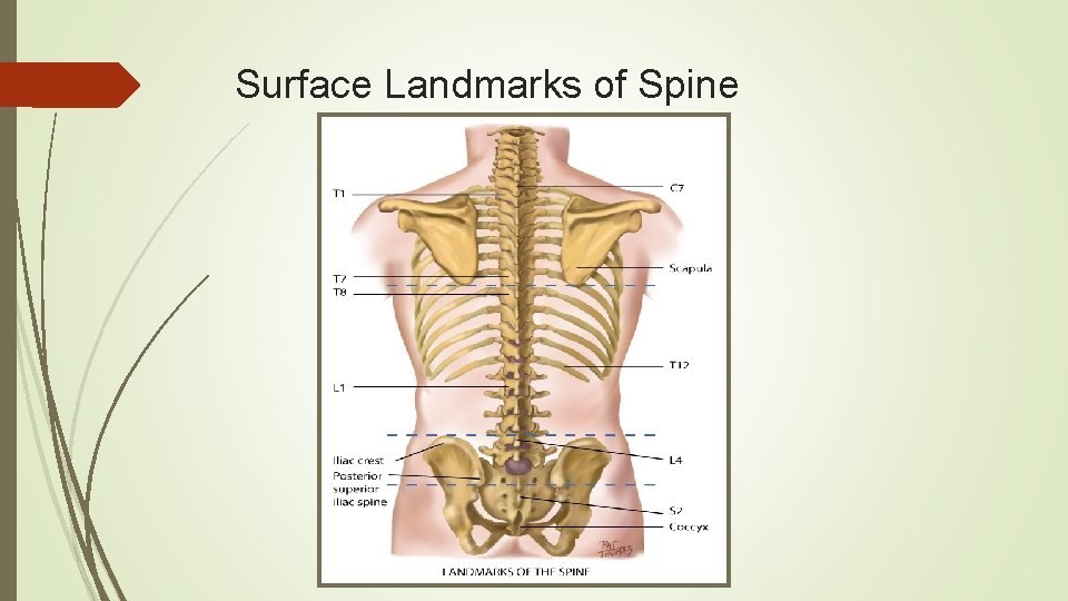 Surface Landmarks of Spine 