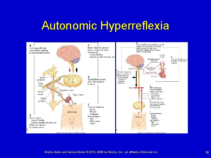 Chapter 17 Disorders of the Central and Peripheral