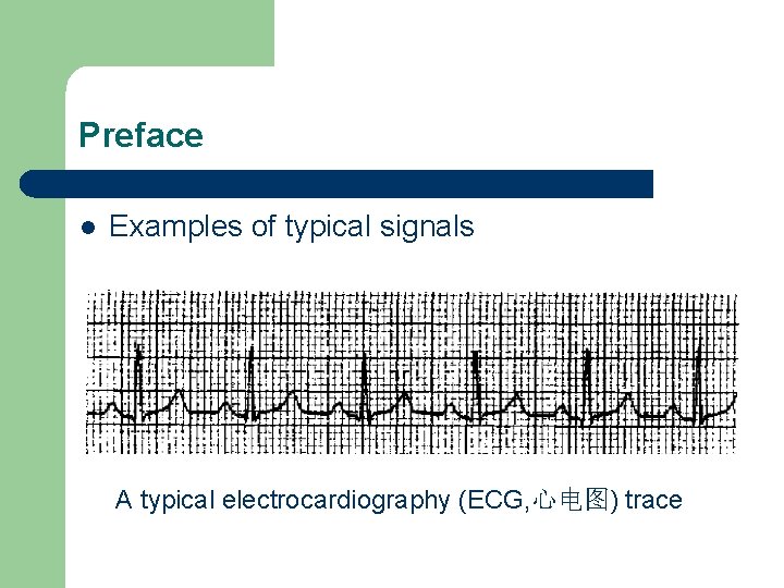 Preface l Examples of typical signals A typical electrocardiography (ECG, 心电图) trace 