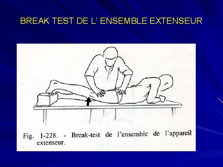 BREAK TEST DE L’ ENSEMBLE EXTENSEUR 