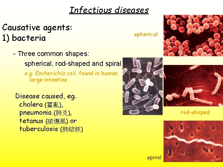 Infectious diseases Causative agents: 1) bacteria spherical - Three common shapes: spherical, rod-shaped and