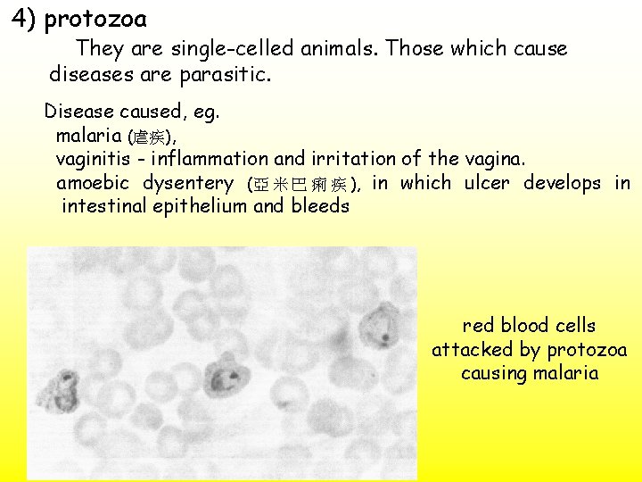 4) protozoa They are single-celled animals. Those which cause diseases are parasitic. Disease caused,