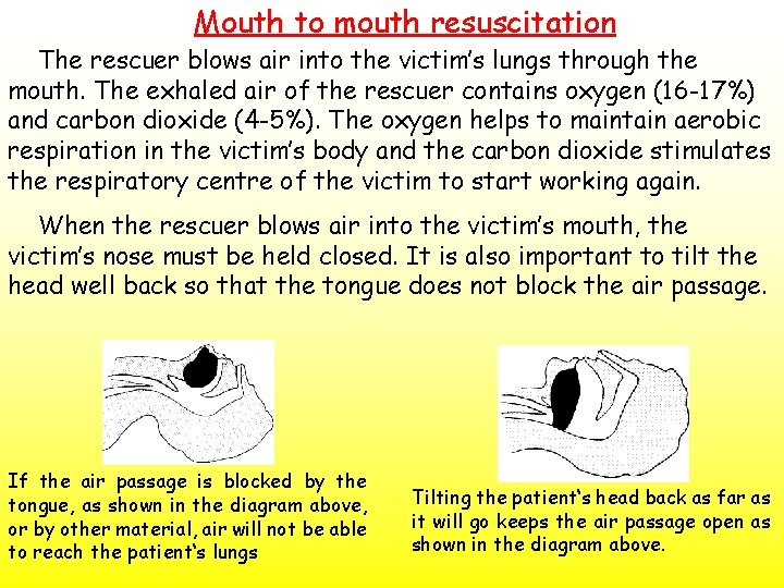 Mouth to mouth resuscitation The rescuer blows air into the victim’s lungs through the