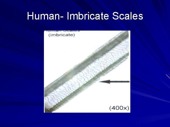 Human- Imbricate Scales 