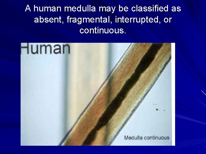 A human medulla may be classified as absent, fragmental, interrupted, or continuous. 