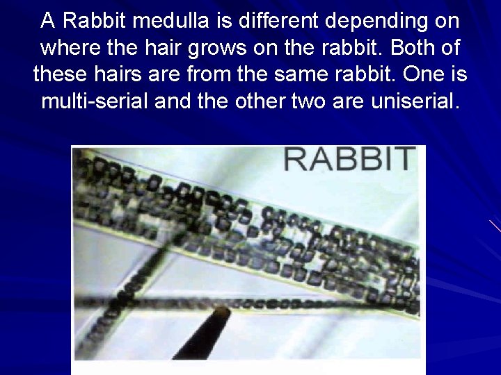 A Rabbit medulla is different depending on where the hair grows on the rabbit.