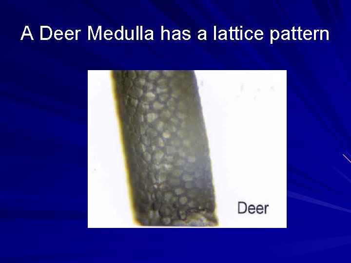 A Deer Medulla has a lattice pattern 