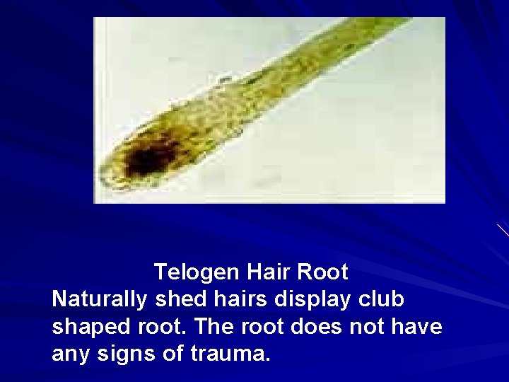 Telogen Hair Root Naturally shed hairs display club shaped root. The root does not