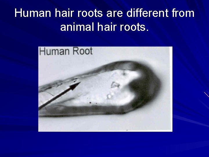 Human hair roots are different from animal hair roots. 