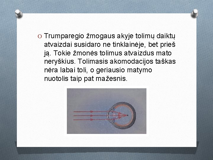 O Trumparegio žmogaus akyje tolimų daiktų atvaizdai susidaro ne tinklainėje, bet prieš ją. Tokie O Trumparegio žmogaus akyje tolimų daiktų atvaizdai susidaro ne tinklainėje, bet prieš ją. Tokie