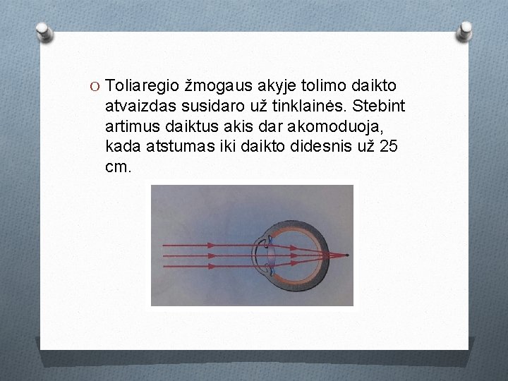 O Toliaregio žmogaus akyje tolimo daikto atvaizdas susidaro už tinklainės. Stebint artimus daiktus akis O Toliaregio žmogaus akyje tolimo daikto atvaizdas susidaro už tinklainės. Stebint artimus daiktus akis
