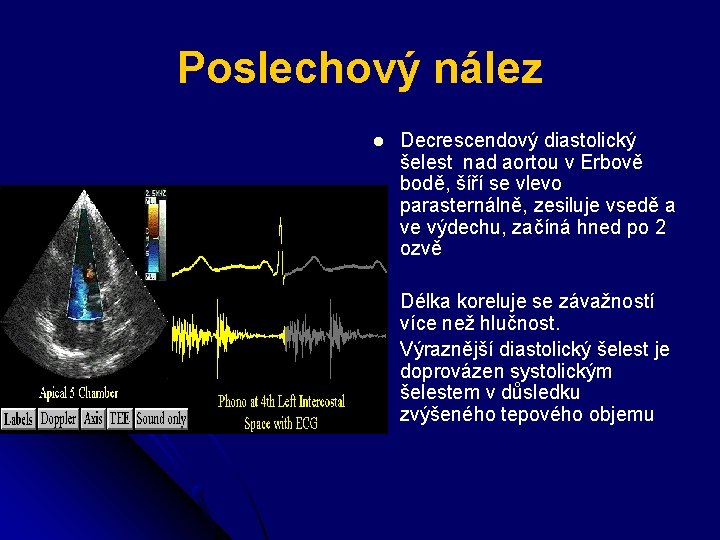 Poslechový nález l Decrescendový diastolický šelest nad aortou v Erbově bodě, šíří se vlevo