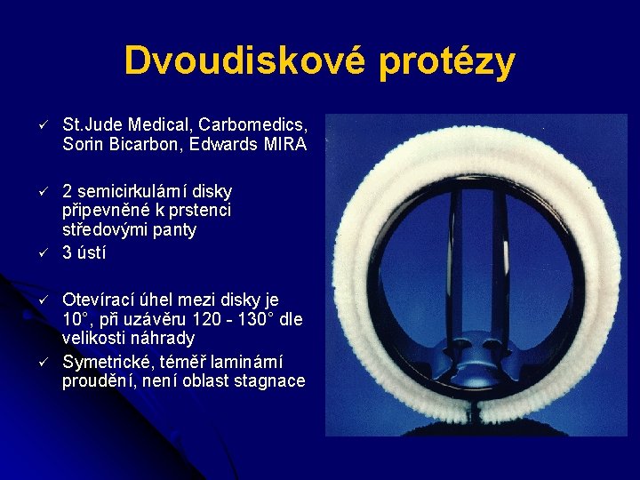 Dvoudiskové protézy ü St. Jude Medical, Carbomedics, Sorin Bicarbon, Edwards MIRA ü 2 semicirkulární
