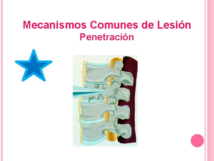 Mecanismos Comunes de Lesión Penetración 