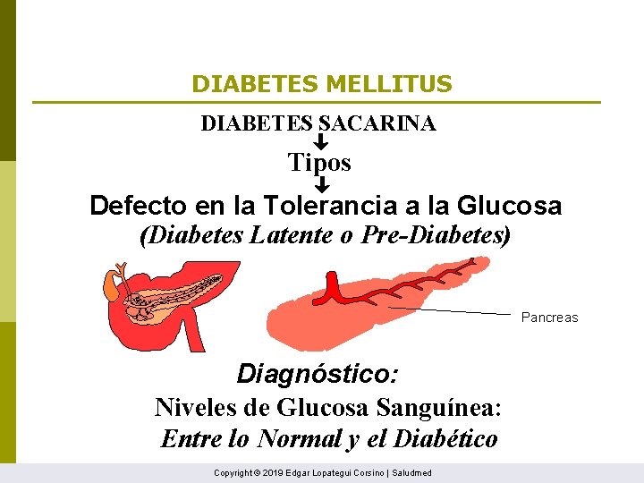 DIABETES MELLITUS DIABETES SACARINA Tipos Defecto en la Tolerancia a la Glucosa (Diabetes Latente