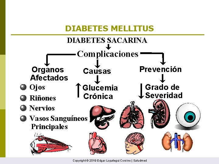 DIABETES MELLITUS DIABETES SACARINA Complicaciones Organos Causas Afectados Ojos Glucemia Crónica Riñones Nervios Vasos