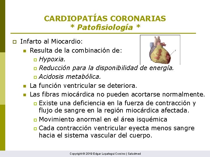 CARDIOPATÍAS CORONARIAS * Patofisiología * p Infarto al Miocardio: n Resulta de la combinación