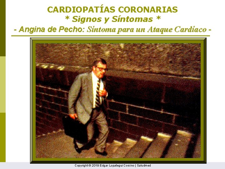 CARDIOPATÍAS CORONARIAS * Signos y Síntomas * - Angina de Pecho: Síntoma para un