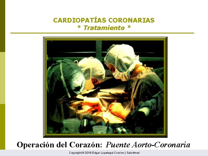 CARDIOPATÍAS CORONARIAS * Tratamiento * Operación del Corazón: Puente Aorto-Coronaria Copyright © 2019 Edgar