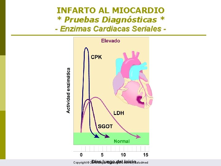 INFARTO AL MIOCARDIO * Pruebas Diagnósticas * - Enzimas Cardiacas Seriales - Copyright ©