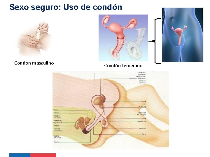 Sexo seguro: Uso de condón Condón masculino Condón femenino Sexo seguro: Uso de condón Condón masculino Condón femenino