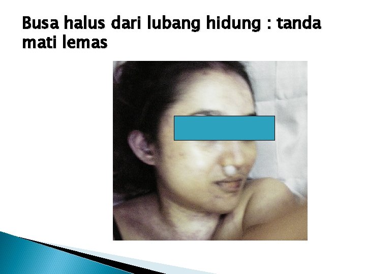 Busa halus dari lubang hidung : tanda mati lemas 