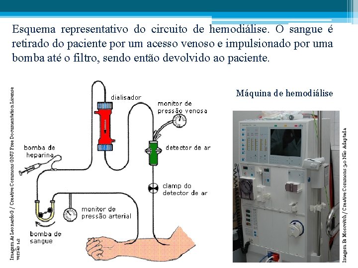 Máquina de hemodiálise Imagem B: Moscvitch / Creative Commons 3. 0 Não Adaptada Imagem
