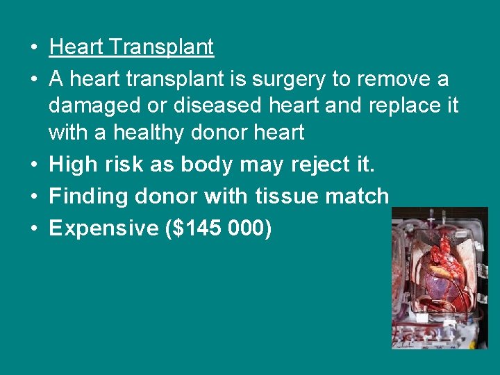  • Heart Transplant • A heart transplant is surgery to remove a damaged