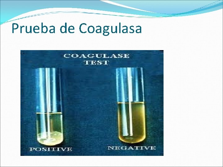 Prueba de Coagulasa Prueba de Coagulasa