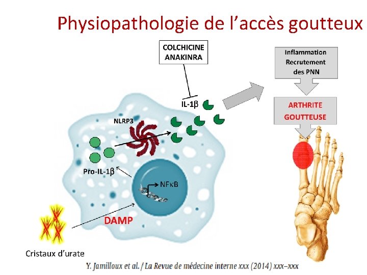 Physiopathologie de l’accès goutteux Physiopathologie de l’accès goutteux