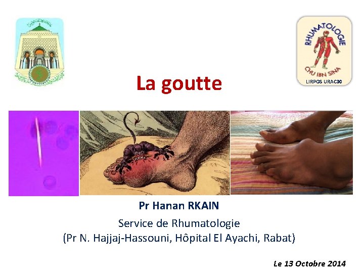 La goutte LIRPOS URAC 30 Pr Hanan RKAIN Service de Rhumatologie (Pr N. Hajjaj-Hassouni, La goutte LIRPOS URAC 30 Pr Hanan RKAIN Service de Rhumatologie (Pr N. Hajjaj-Hassouni,