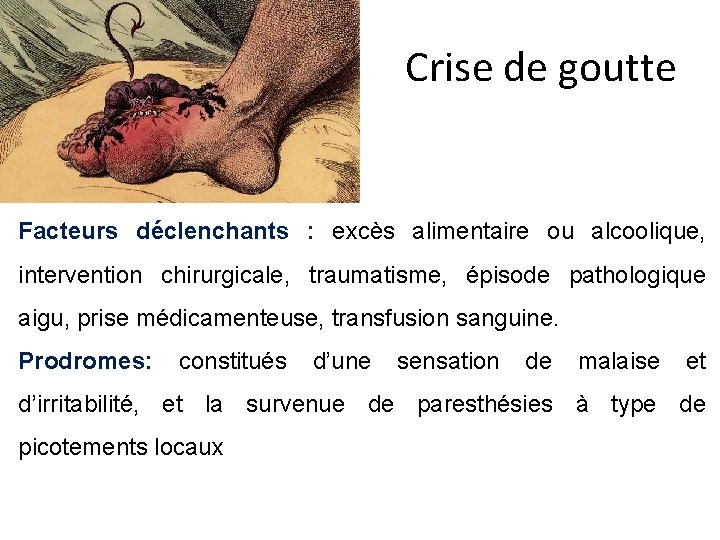 Crise de goutte Facteurs déclenchants : excès alimentaire ou alcoolique, intervention chirurgicale, traumatisme, épisode Crise de goutte Facteurs déclenchants : excès alimentaire ou alcoolique, intervention chirurgicale, traumatisme, épisode