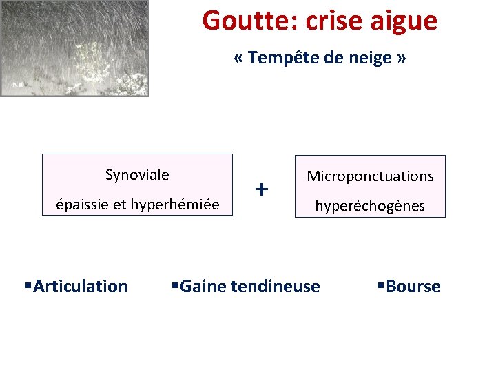 Goutte: crise aigue « Tempête de neige » Synoviale épaissie et hyperhémiée §Articulation + Goutte: crise aigue « Tempête de neige » Synoviale épaissie et hyperhémiée §Articulation +