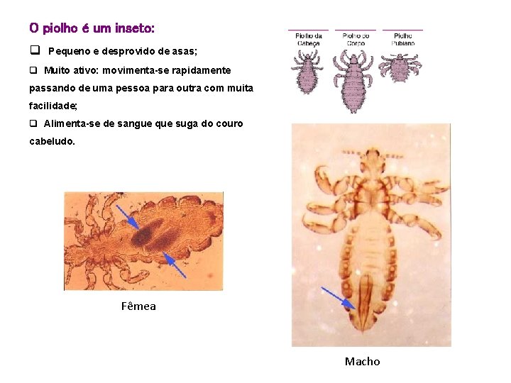 O piolho é um inseto: q Pequeno e desprovido de asas; q Muito ativo: