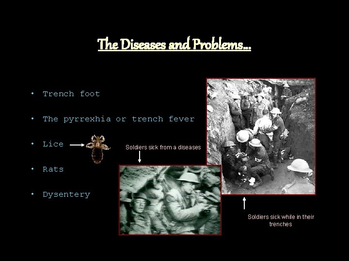 The Diseases and Problems… • Trench foot • The pyrrexhia or trench fever •