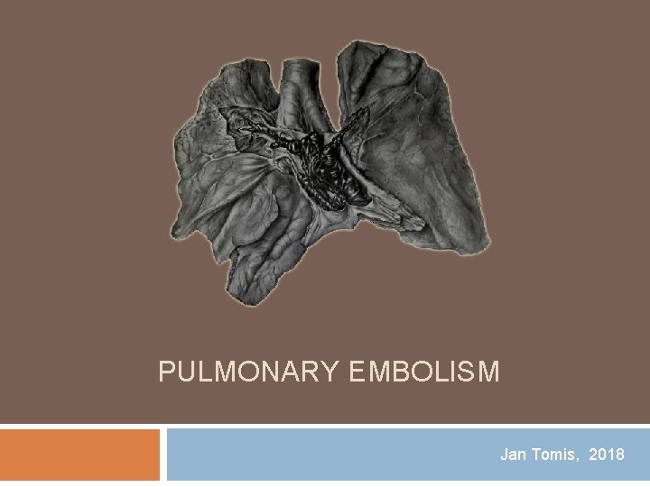 PULMONARY EMBOLISM Jan Tomis, 2018 