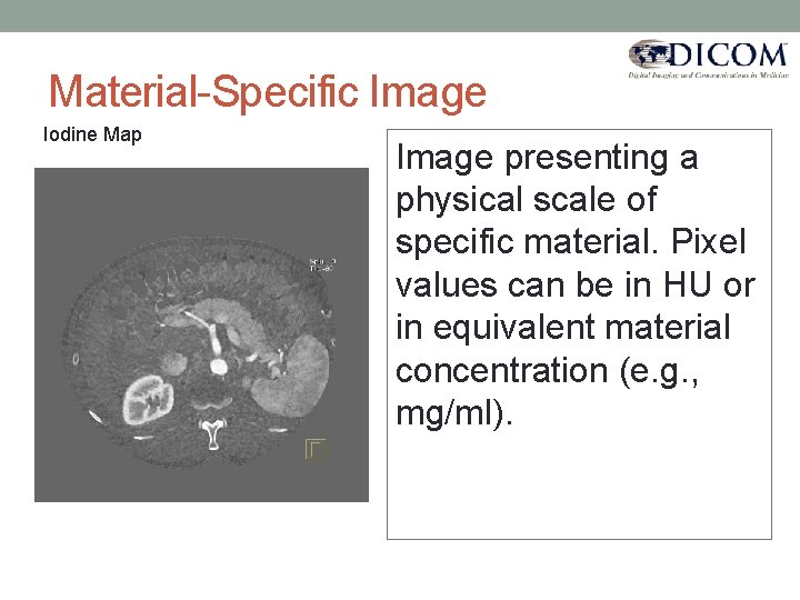 Material-Specific Image Iodine Map Image presenting a physical scale of specific material. Pixel values