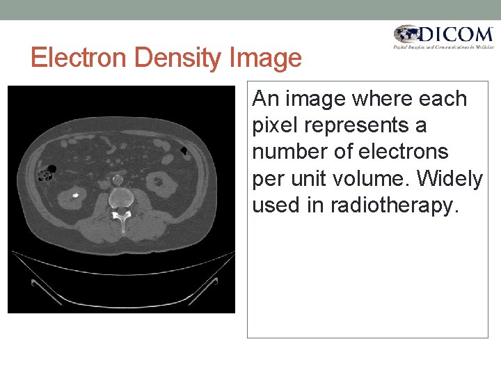 Electron Density Image An image where each pixel represents a number of electrons per