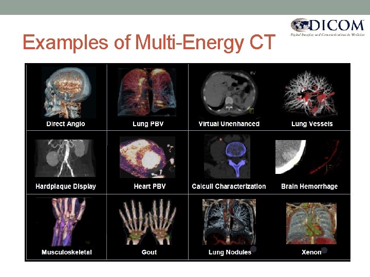 Examples of Multi-Energy CT 