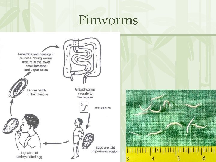 Pinworms 